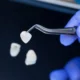 Dental-Veneers-in-Livonia-MI