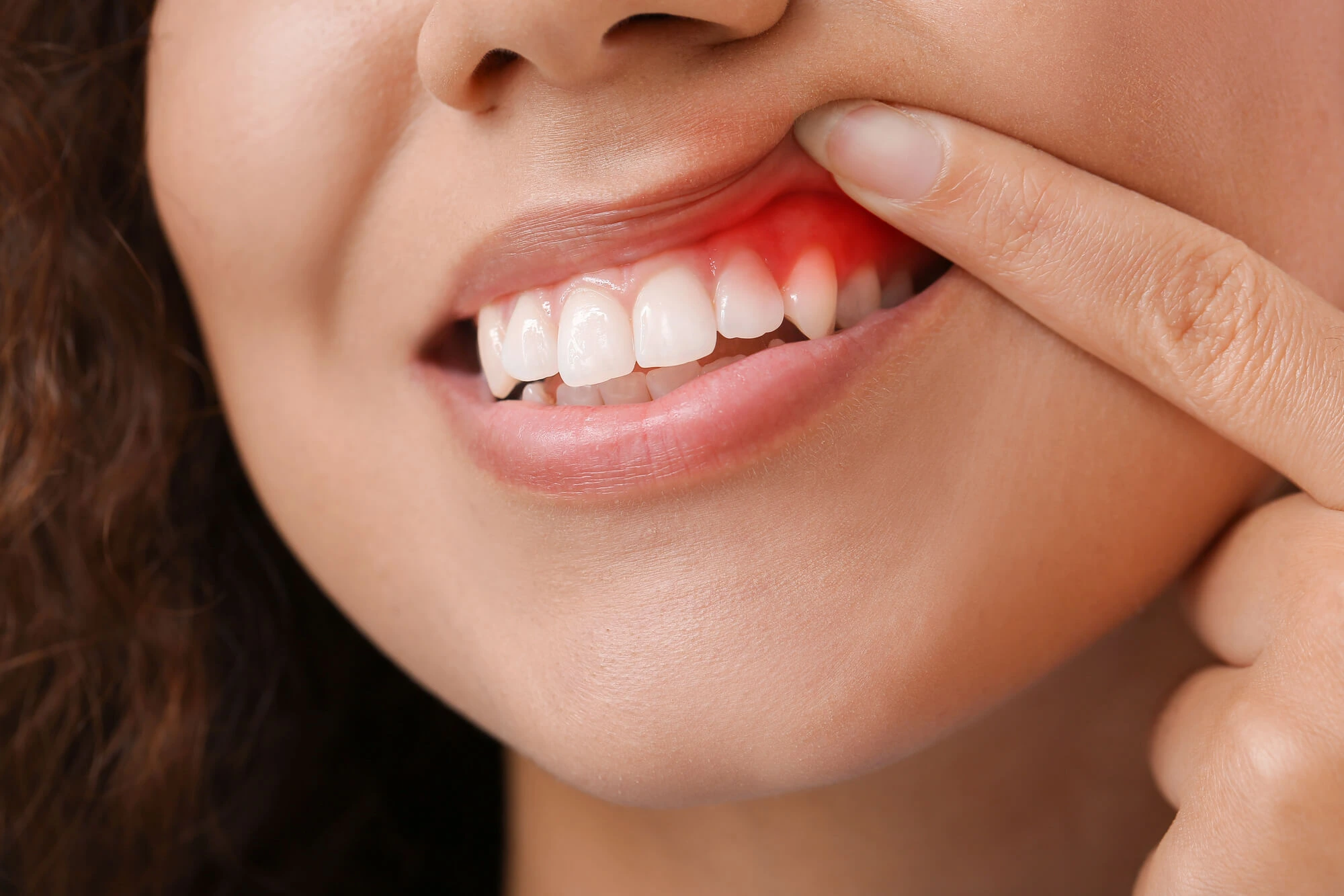 What-Is-a-Distal-Wedge-Procedure-in-Michigan