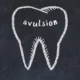 tooth avulsion educational dental diagram