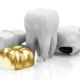 dental-crown-restorations-livonia-mi-tooth-restoration